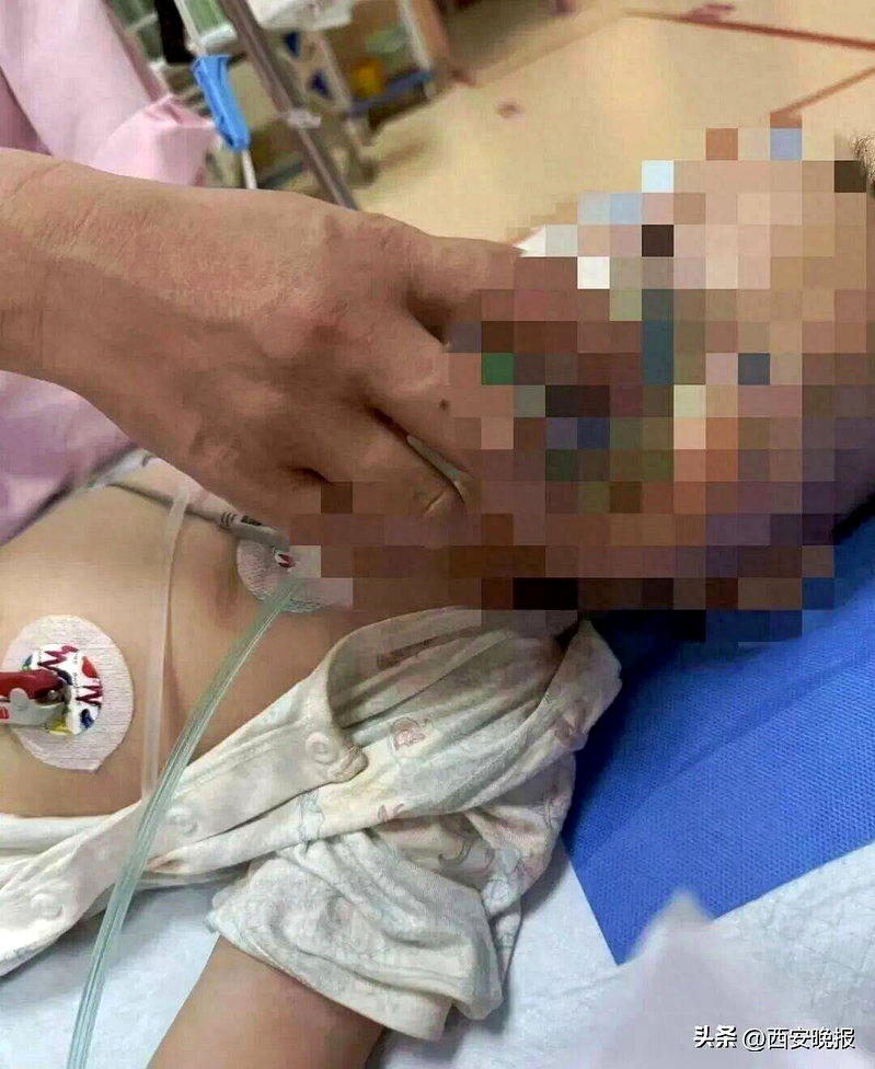 颜先生1岁的儿子吃了毒鸡蛋,被送医抢救。(取材自西安晚报/受访者供图)