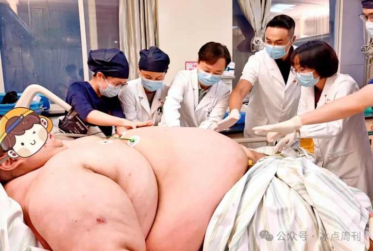 317公斤云南男跨省减重 13人擡送医 手术麻醉如「肉缝找钥匙孔」 多学科专家为余晓洲会诊。(取材自冰点周刊)