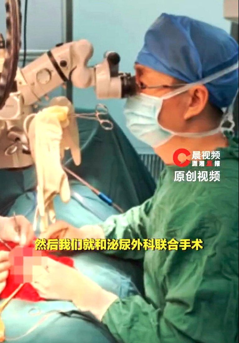 湖南男拿刀切断阴茎 医师花6小时接回 恢复那方面功能 医师为该名患者进行6小时显微手术,将他的阴茎成功再植,并恢复勃起功能,(取材自晨...